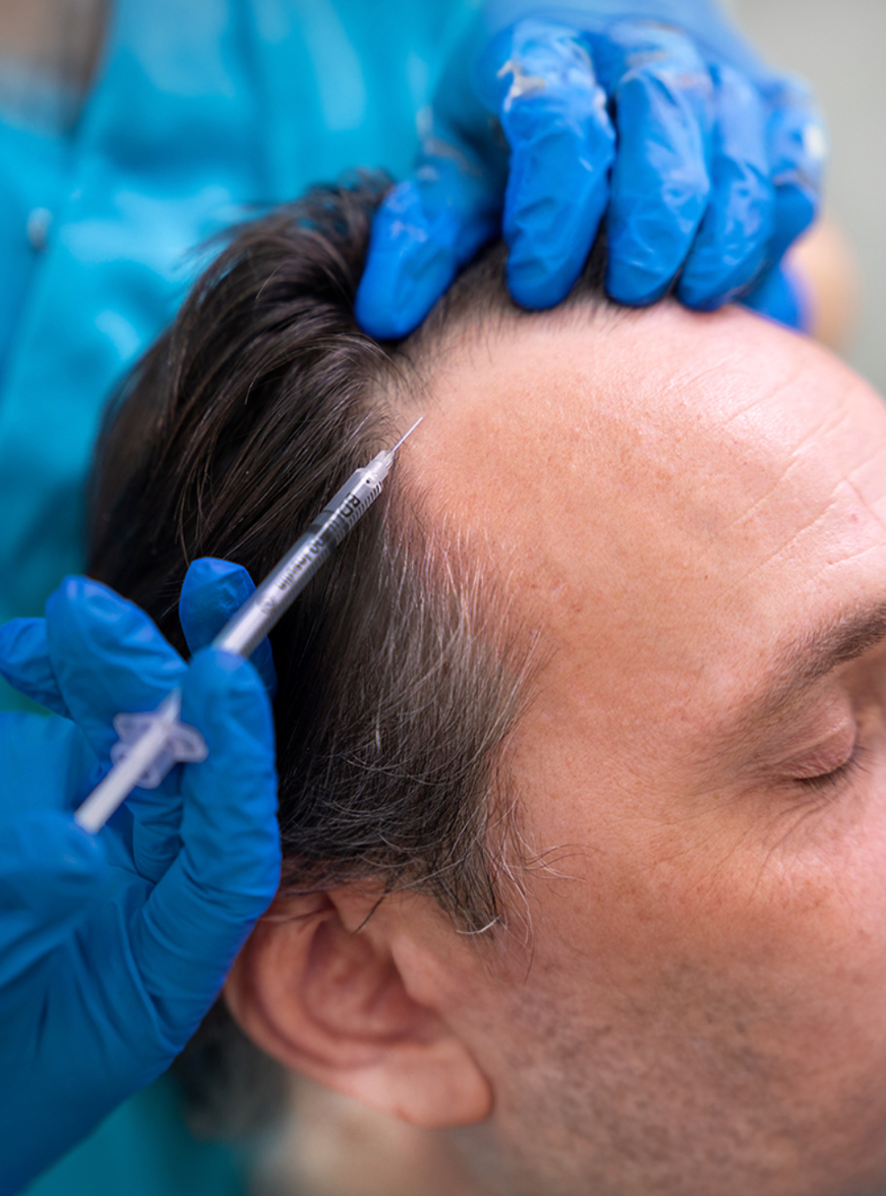 Stem Cell Therapy